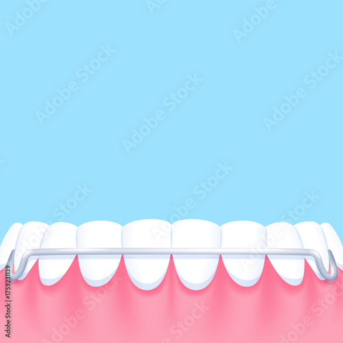 Lower teeth (Hawley retainer) - Text box sign blank banner (square) illustration vector design. Dental care concept.