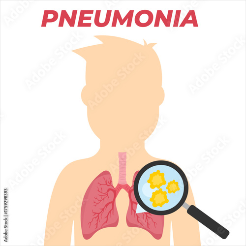 Silhouette of a human examined with a magnifying glass, symbolizing medical diagnosis for pneumonia or lung disease, flat art design style.
