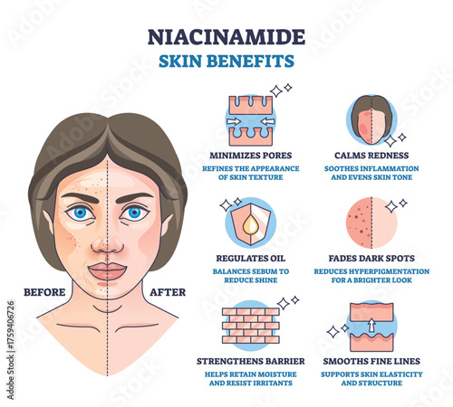 Niacinamide skin benefits diagram shows a before-after face, pore arrows and skin barrier icons, conveying calm tone, fewer spots, and smoother texture. Outline diagram