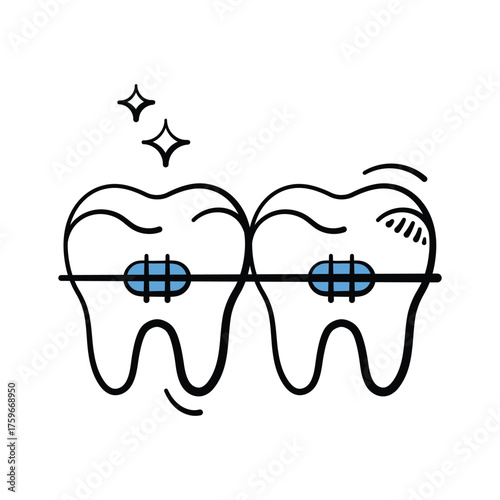 Dental braces for teeth alignment and orthodontic treatment