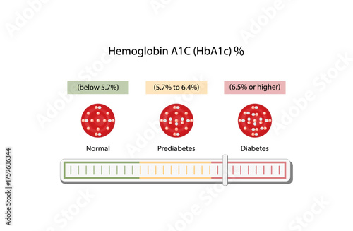 Hemoglobin A1C, HbA1c test , HbA1c levels, Glucose sticks to hemoglobin, glycated hemoglobin, up to 120 days. A1C Blood Sugar Test, Diabetes Mellitus, Infographic, Vector illustration.