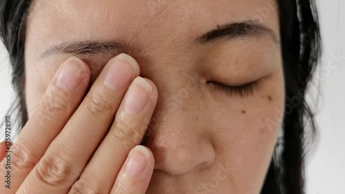 Rubbing Closed Eyes: Dry, Irritated Eyes and Eye Care Concept,feeling tired eyes. Eye strain and migraine after computer work