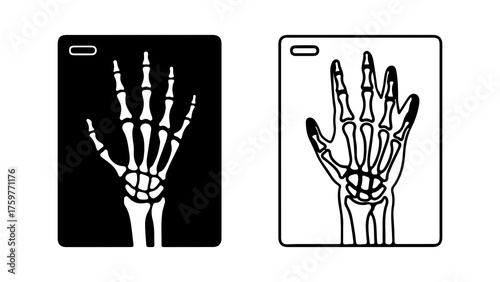 Hand x-ray scans with medical background
