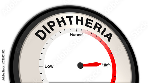 Foto Diphtheria at high severity displayed on a barometer or tachometer, showing seve