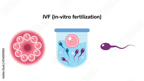 In Vitro Fertilization Process Concept Depicting Egg Sperm and Lab Container A Visual Representation of Assisted Reproductive Technology
