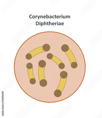 Corynebacterium diphtheriae vector illustration. Corynebacterium diphtheriae, the bacterium causing diphtheria disease. Medical and microbiology concept showing rod-shaped bacteria under microscope.