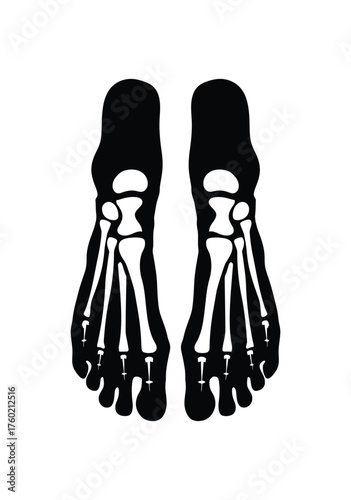 Two skeletal foot silhouettes showcase human anatomy against a stark white backdrop
