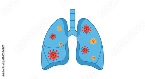 Anatomy of human lungs displaying a viral infection, highlighting the presence of pathogenic microorganisms within the respiratory system and pulmonary tissue