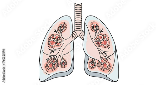Detailed illustration of healthy lungs depicting bronchioles, alveoli, and respiratory structures in anatomical diagram