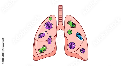 Illustration of lungs with bacteria and viruses, representing respiratory infection.