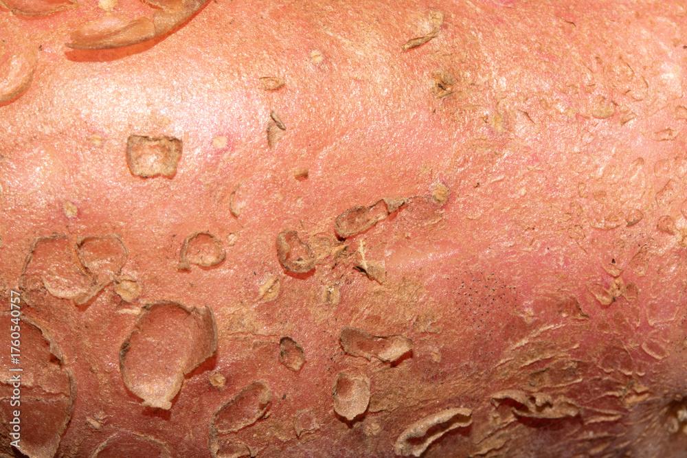 Fototapeta premium Abstract close up of potato natural vegetable flaky skin