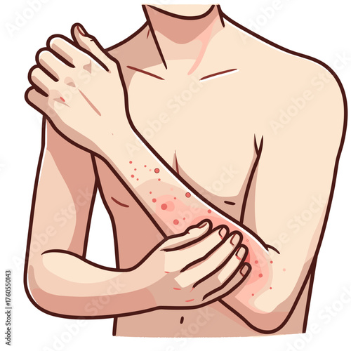 Skin rash on arm
