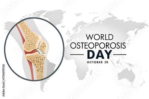 Highlight World Osteoporosis Day with a global visual of porous bone structure. A clinical design promoting awareness of fracture risk and bone health on October 20. generative ai
