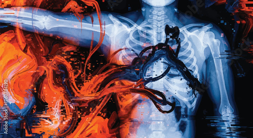 Abstract visualization of internal turmoil with a human torso x-ray background showing fiery energy and dark organic growth
