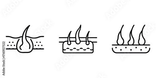 Hair follicle diagram: a series of illustrative diagrams showing the anatomical structure of skin hair follicles. 