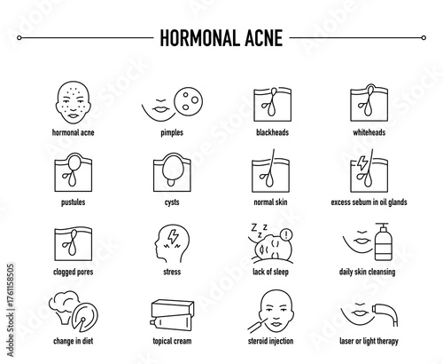 Hormonal Acne symptoms, diagnostic and treatment vector icon set. Line editable medical icons.