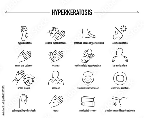 Hyperkeratosis symptoms, diagnostic and treatment vector icon set. Line editable medical icons.