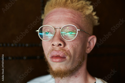 Portrait of an albino man with round glasses