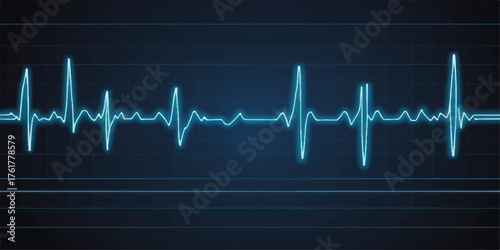 Electrocardiogram EKG heartbeat line on a medical monitor