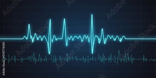 Green ECG heart rate line graph illustrating a vital cardiogram pulse wave on a medical monitor