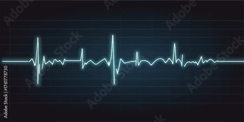 Green EKG line showing heartbeat pulse on a monitor graph for health and medical test in a hospital