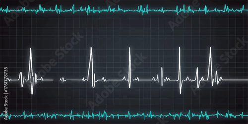 Blue medical monitor displaying an ECG heartbeat graph, illustrating the pulse rate and wave of life in cardiology