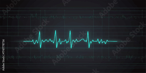 EKG heartbeat on a monitor screen showing a medical cardiogram wave chart