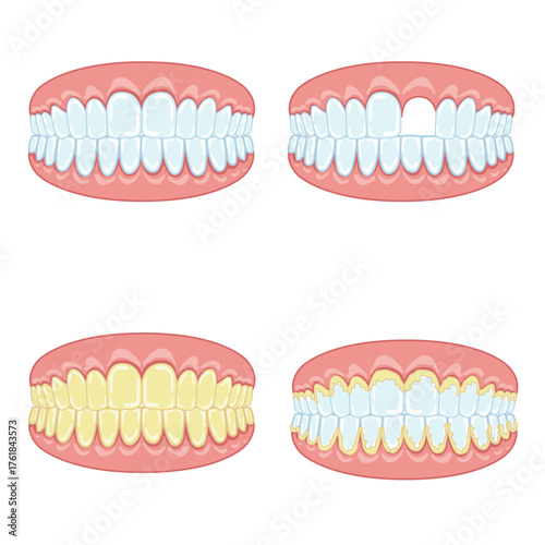 Illustration of tooth gums mouth dentist healthy medical anatomy oral dental care yellow teeth plaque