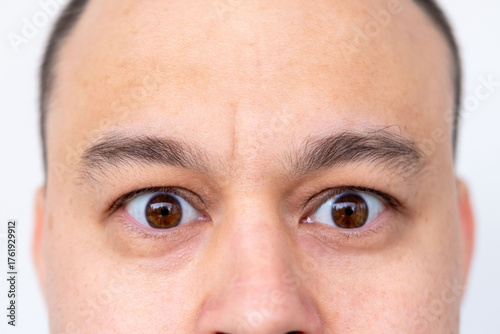 middle-aged Amazed man with bulging eyes, stares in shock, man upper face close-up, goggle eyes in fright, staring at camera, strong surprise or fright, horror in look, disbelief and unexpected news