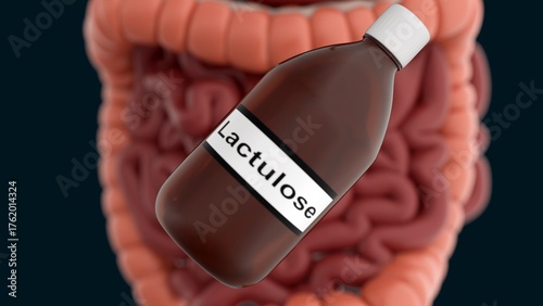 Quadro em tela A 3d illustration of bottle labeled Lactulose and human intestines