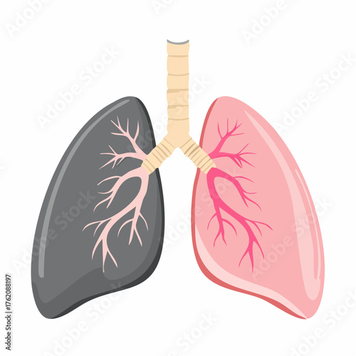 Healthy and sick lungs vector icon. Pink healthy lungs and black damaged lungs symbolizing good vs bad respiratory health. Medical, anatomy, and healthcare concept illustration