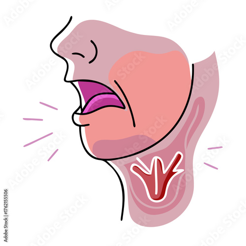 A person with an open mouth and highlighted throat, showing vocal cord irritation or a sore throat. Ideal for blogs on vocal health, singing, or medical symptoms