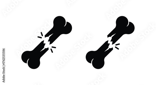 A simple graphic illustration of a broken bone depicted twice