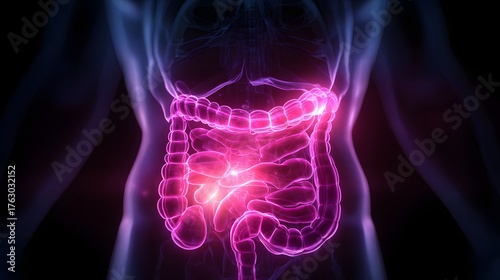 Glowing 3D medical x-ray showing human digestive system with highlighted intestines and red pain areas, representing abdominal inflammation or infection.