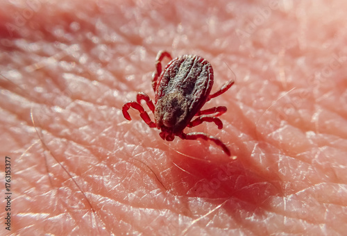 Obraz na płótnie Close-up macro of a tick crawling on human skin