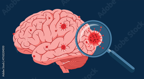 Brain with Virus Magnified - Medical Illustration of Infection.