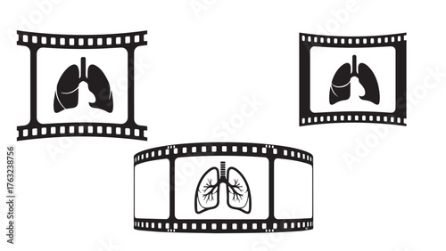 Radiology film strip framing lung outline, minimal black diagnostic icon for screening, imaging, and early detection programs