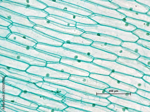 Epidermis einer Zwiebel (Allium sp.) unter Mikroskop bei 200facher Vergrößerung mit Skala 200µm