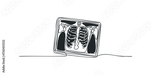 Minimalist outline of a chest x-ray on white