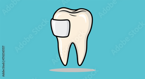 Clean tooth filling illustration showing healthy dental restoration on light blue background. Detailed tooth filling with white composite material highlights proper oral care.