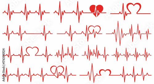 Collection of EKG electrocardiogram heart rhythm lines, representing health, cardiology, and life
