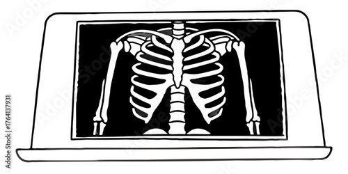 Medical x ray image of human skeleton bones and ribs for science diagnostic radiology and health care study