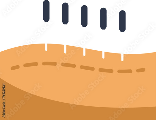 Illustration of acupuncture needles being applied to skin for pain relief