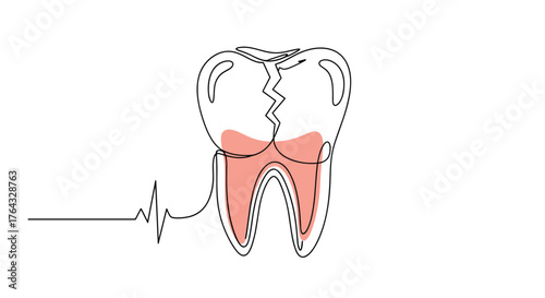 Continuous line drawing of a cracked tooth with a heartbeat line.