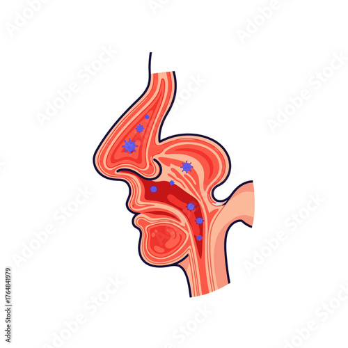 Diagram illustrating viral infection spreading through nasal passages and throat, impacting respiratory health and wellness
