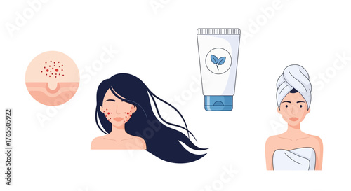 Illustrations showing skincare steps, from problem skin to healthy complexion with product.