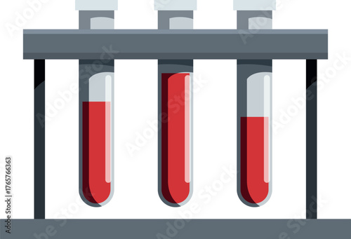 Three test tubes containing blood samples are resting on a metal rack in a medical laboratory setting