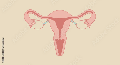 Anatomical illustration of the female reproductive system with uterus ovaries and fallopian tubes.