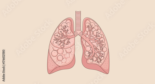 Illustration of Human Lungs with Bronchi and Alveoli.
