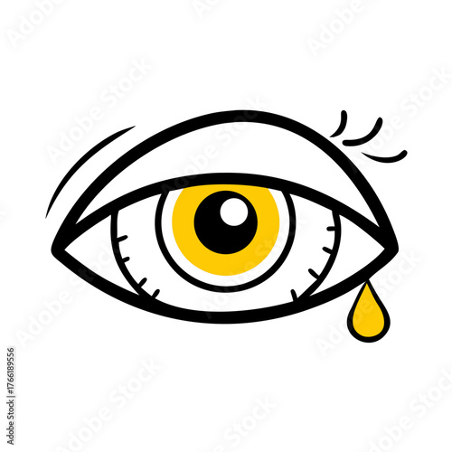 A stylized cartoon eye with a yellow iris and tear, suggesting eye irritation or sadness. Ideal for blogs on eye health, allergies, or emotions.